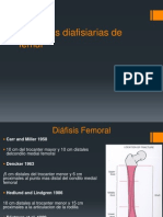 Fracturas Diafisiarias de Femur