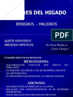 Detección precoz y tratamientos efectivos del hepatocarcinoma