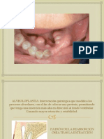 cirugiapreprotesica-121214153925-phpapp02