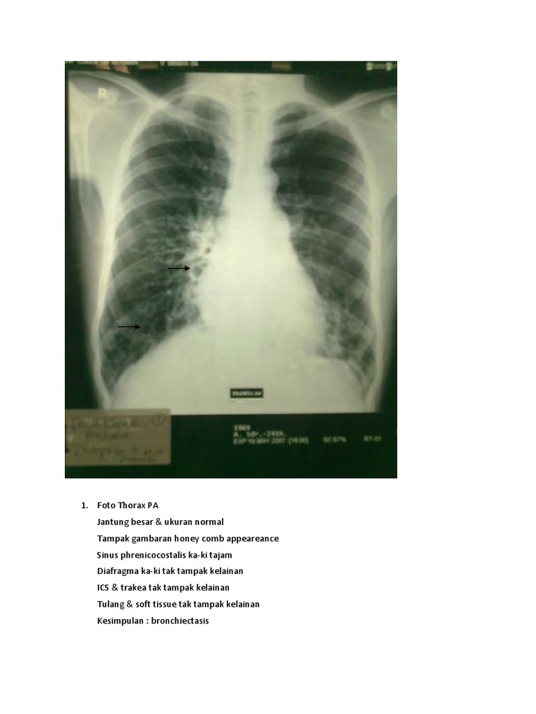 Radiologi Cara Baca | PDF