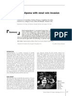 Renal Angiomyolipoma With Renal Vein Invasion: Ase Report