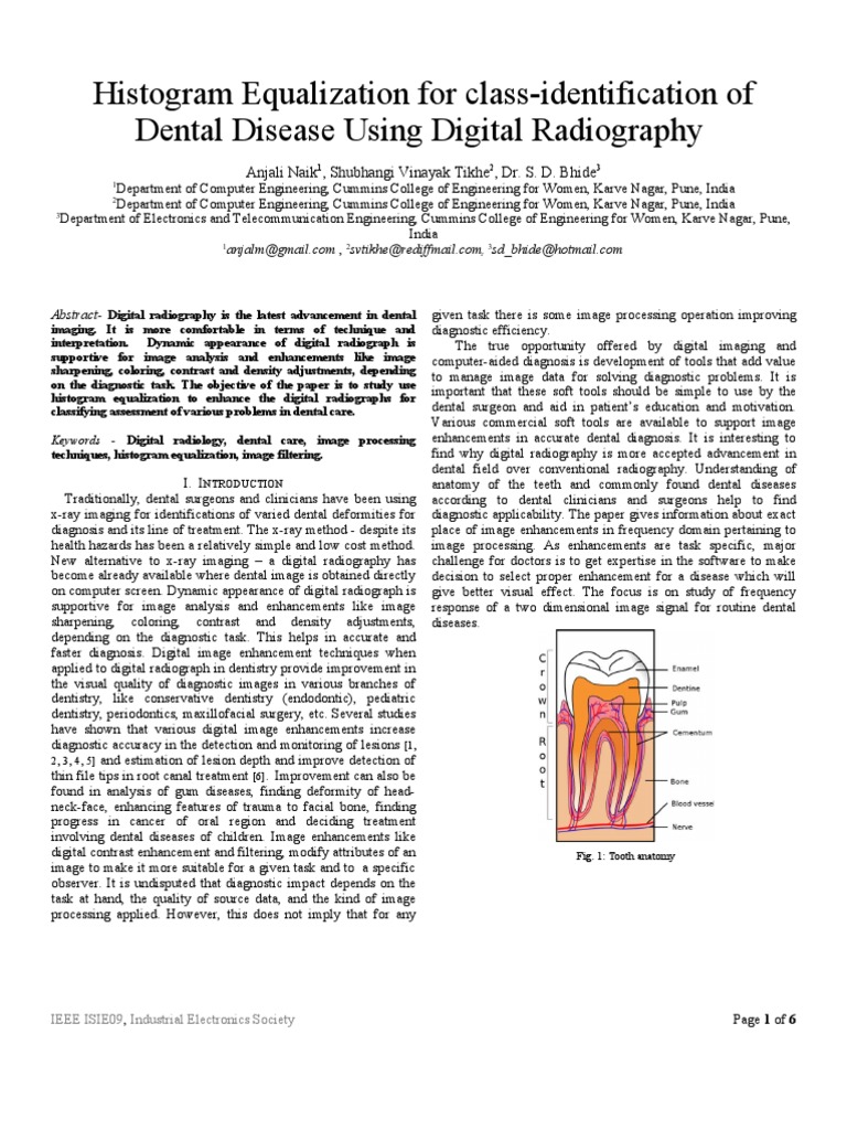 Histogram Equalization For ClassIdentification of Dental Disease Using