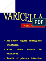 Varicella Inggris