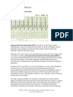 Supraventricular Tachycardia