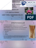 Atrofia Muscular