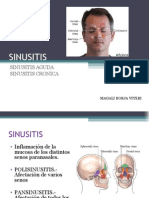 Sinusitis 1