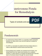 Ateriovenous Fistula