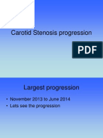 Carotid Stenosis Progression