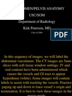 CT Abdomen/Pelvis Anatomy Usc/Som Department of Radiology Kirk Peterson, MD