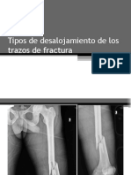 Tipos de Desalojamiento de Los Trazos de Fractura