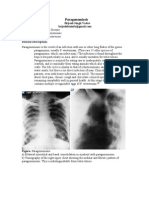 Parasitic disease(Paragonomiasis)