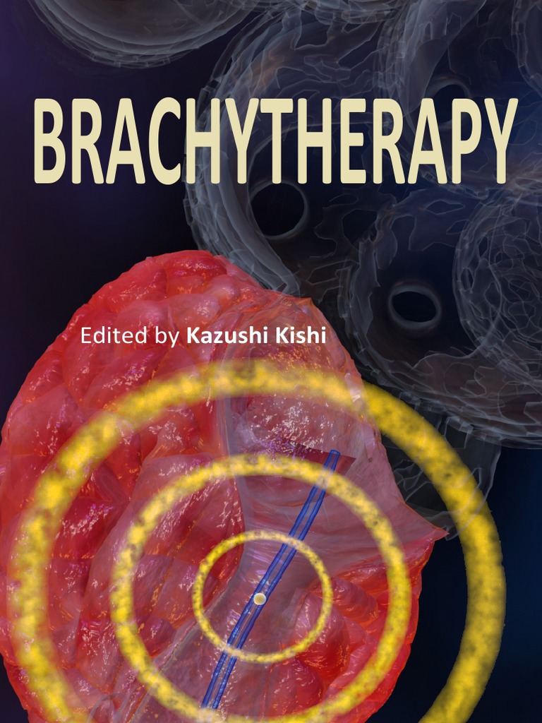 Brachytherapy | Dosimetry | Radiation Therapy | Free 30-day Trial | Scribd
