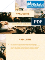 Vasculitis