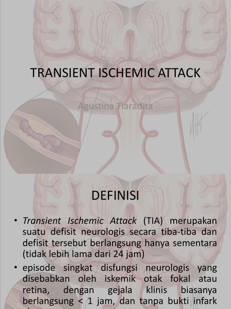 Transient Ischemic Attack | PDF