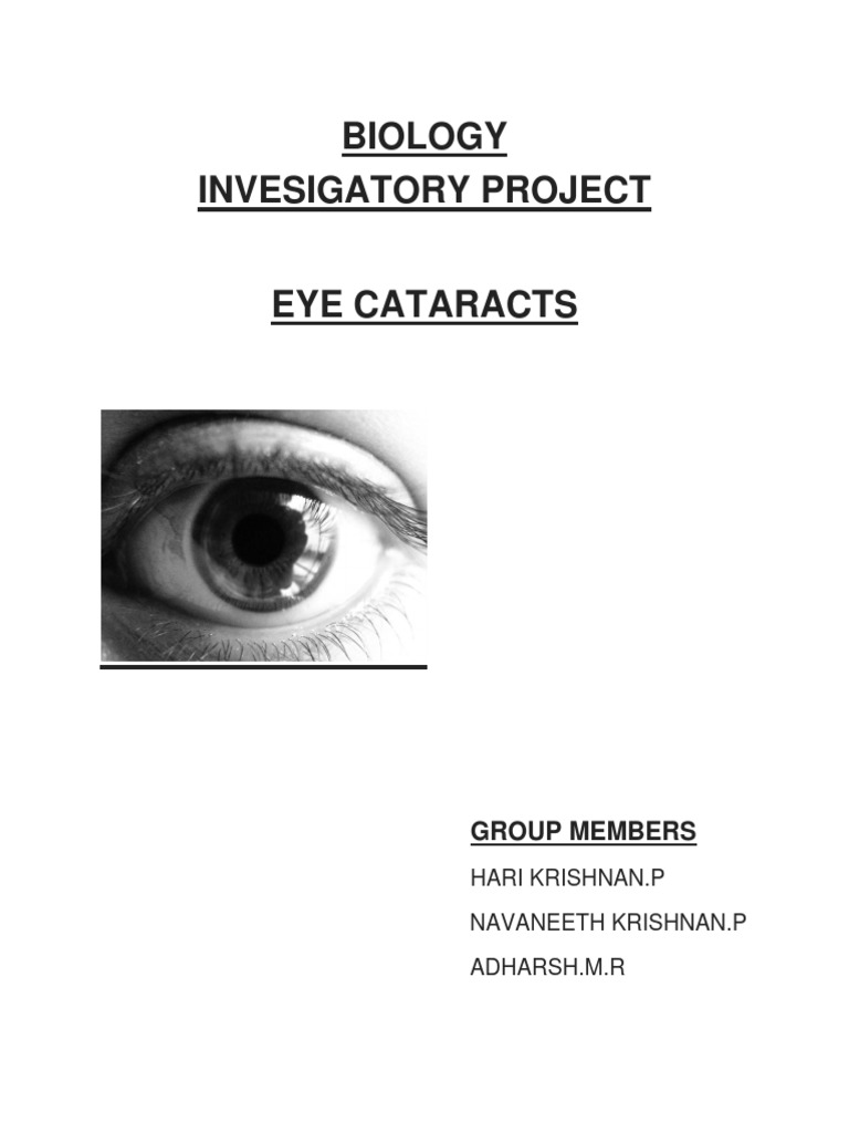 Understanding Eye Cataracts: Causes & Treatment | PDF | Cataract ...