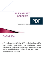 Ectopico Obstetricia III