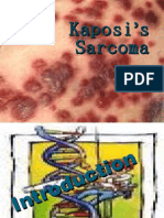 Kaposi's Sarcoma
