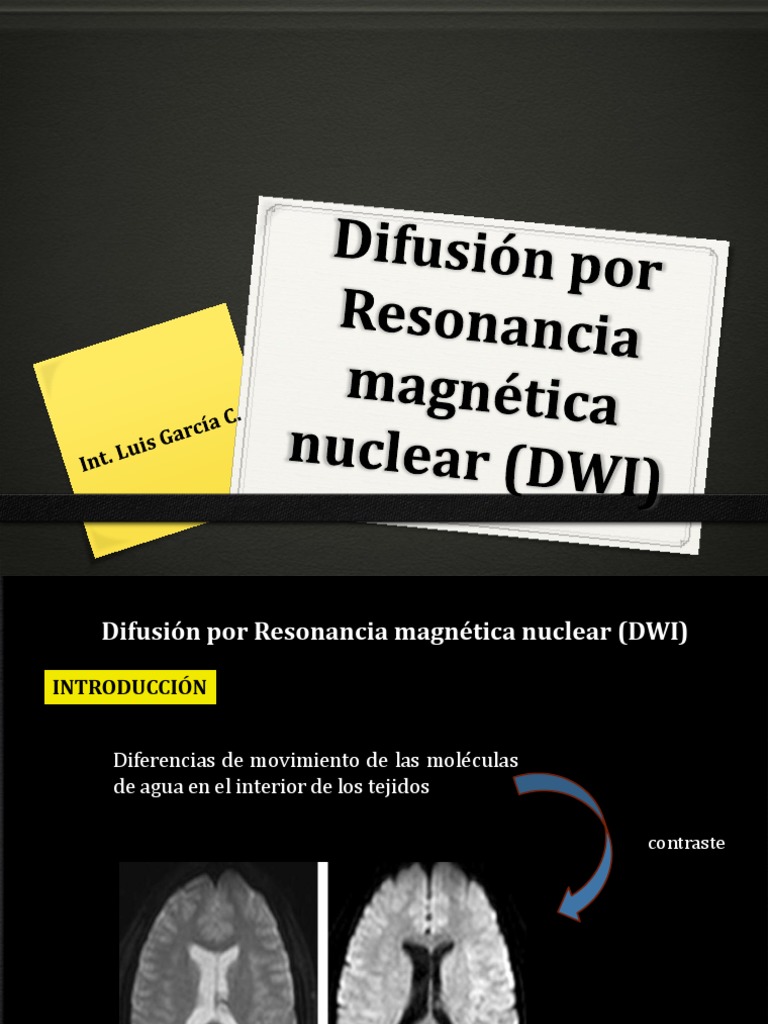 Difusion RM | PDF | Imagen de resonancia magnética | Movimiento (física)