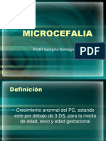 MICROCEFALIA