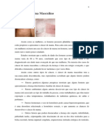 Câncer de Mama Masculino PDF