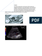 Antenatal Diagnosis - Surgical Aspects