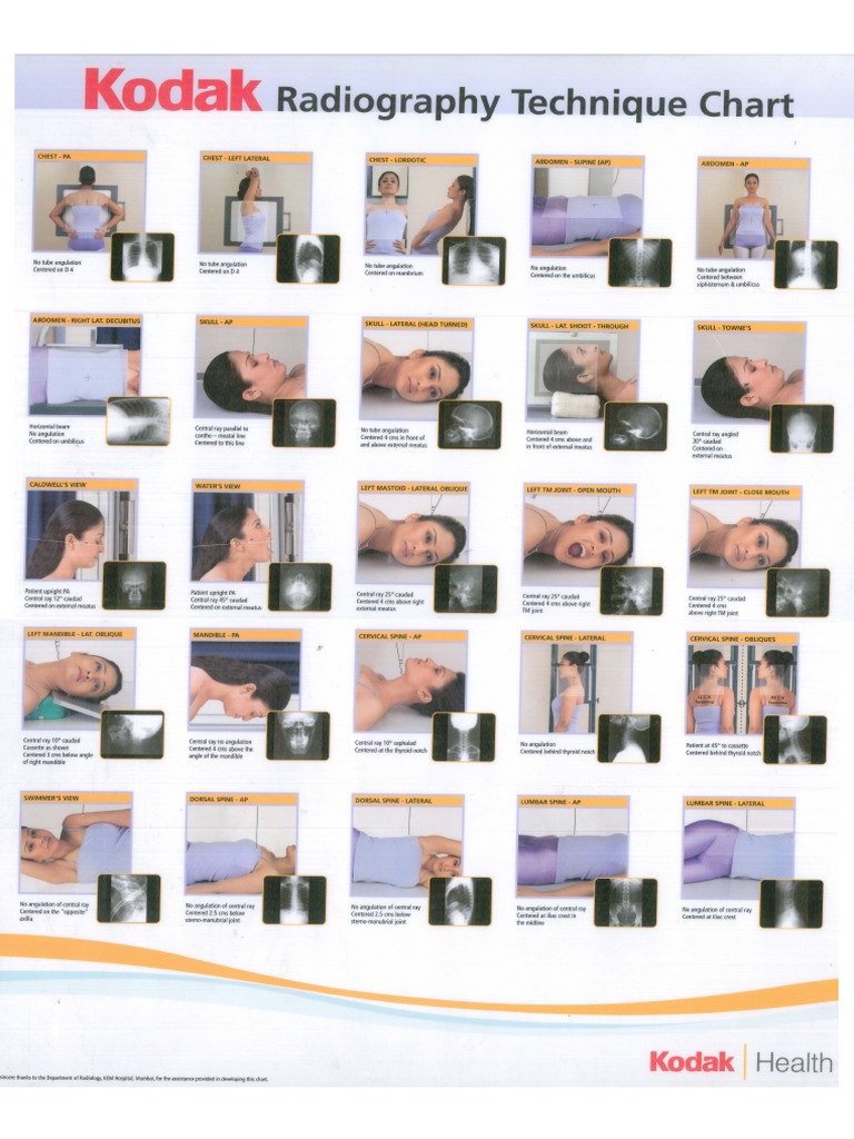 Kodak Radiography Technique Chart PDF