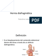 Hernia Diafragmática