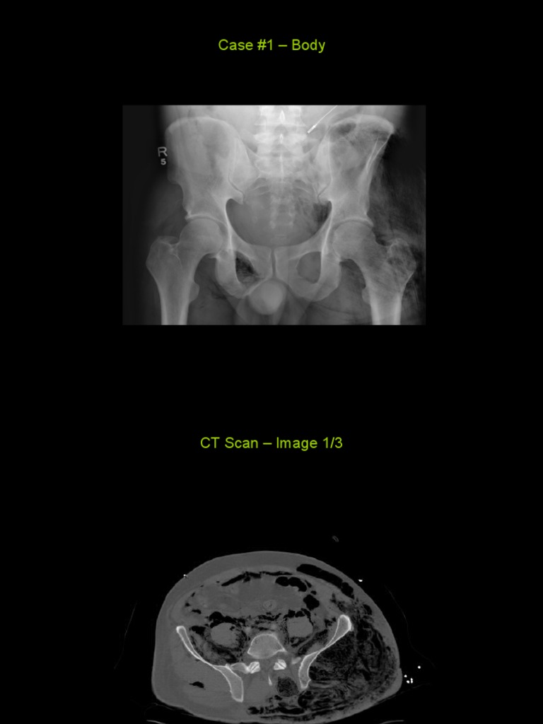 CT Scan Analysis - Case #1 Images | PDF