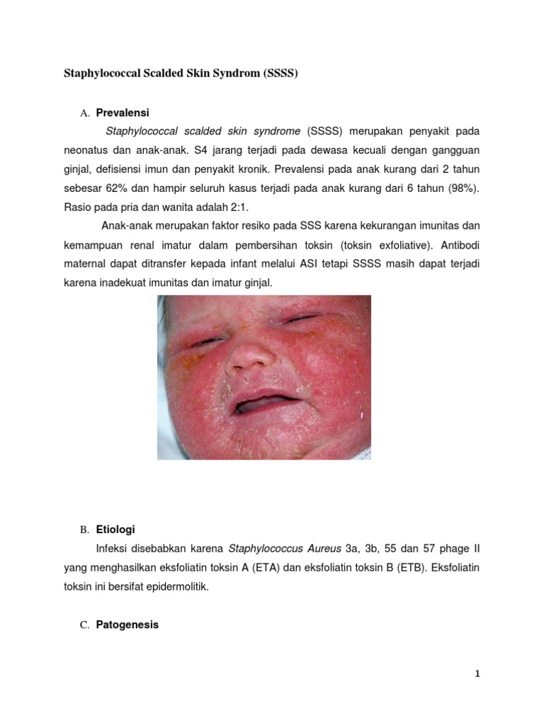 Staphylococcal Scalded Skin Syndrom | PDF