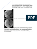 Bile Duct Stricture