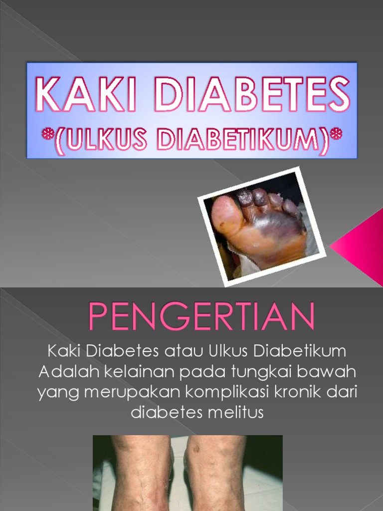 Diabetes Ppt Indonesia
