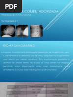 TOMOGRAFIA COMPUTADORIZA aula final.pdf