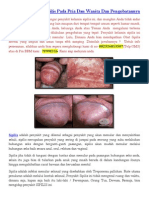 Penyakit Kelamin Sipilis Pada Pria Dan Wanita Dan Pengobatannya - 082326813507