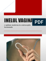 Inelul Vaginal