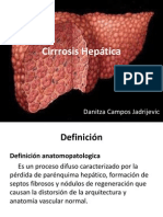 cirrosis presentacion .ppt