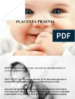 Placenta Praevia E