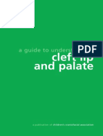 Syndrome Cleft Lip and Palate
