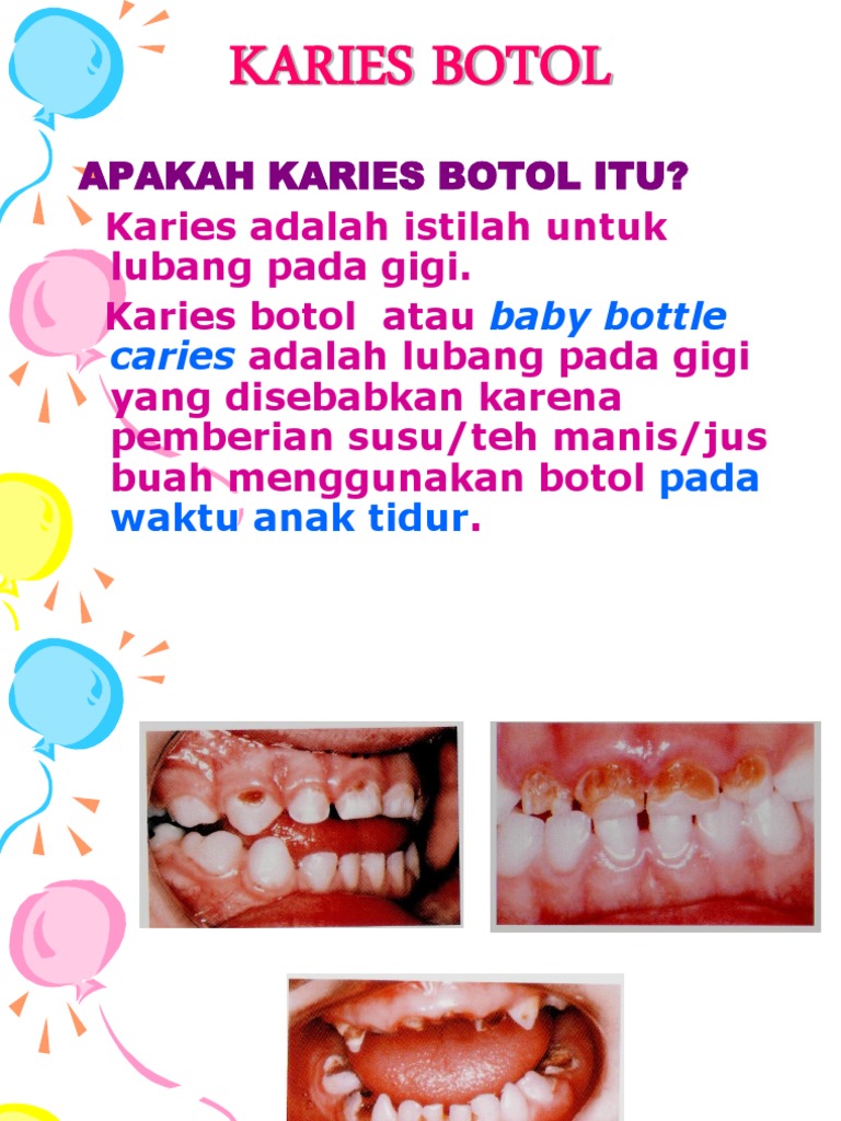 Karies Botol