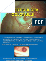 Diverticuloza Colonului