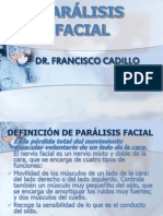 Parálisis facial: causas, síntomas y tratamiento