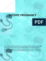 ectopic pregnancy case study scribd addu