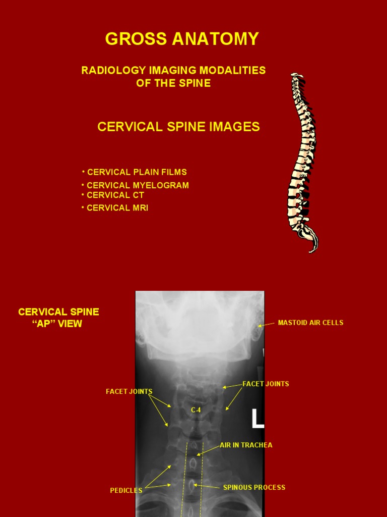 Cervical Spine Imaging Techniques | PDF | Vertebra | Spinal Cord