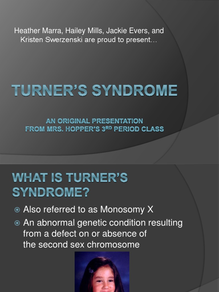 Turner’s Syndrome ppt Clinical Medicine Health Sciences Free 30