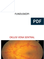 Fundus Kopi