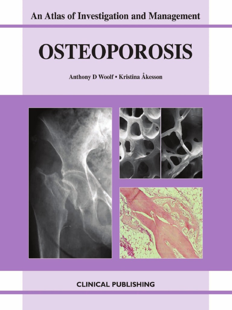 Anthony D. Woolf, Kristina Akesson Osteoporosis An Atlas of ...