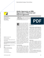 Ankle Ligaments on MRI Appearance of Normal and Injured Ligaments