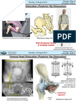 Femoral Head Dislocation (Posterior Hip Dislocation) : Monday, 18 August 2014