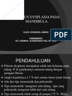 Fibrous Dysplasia