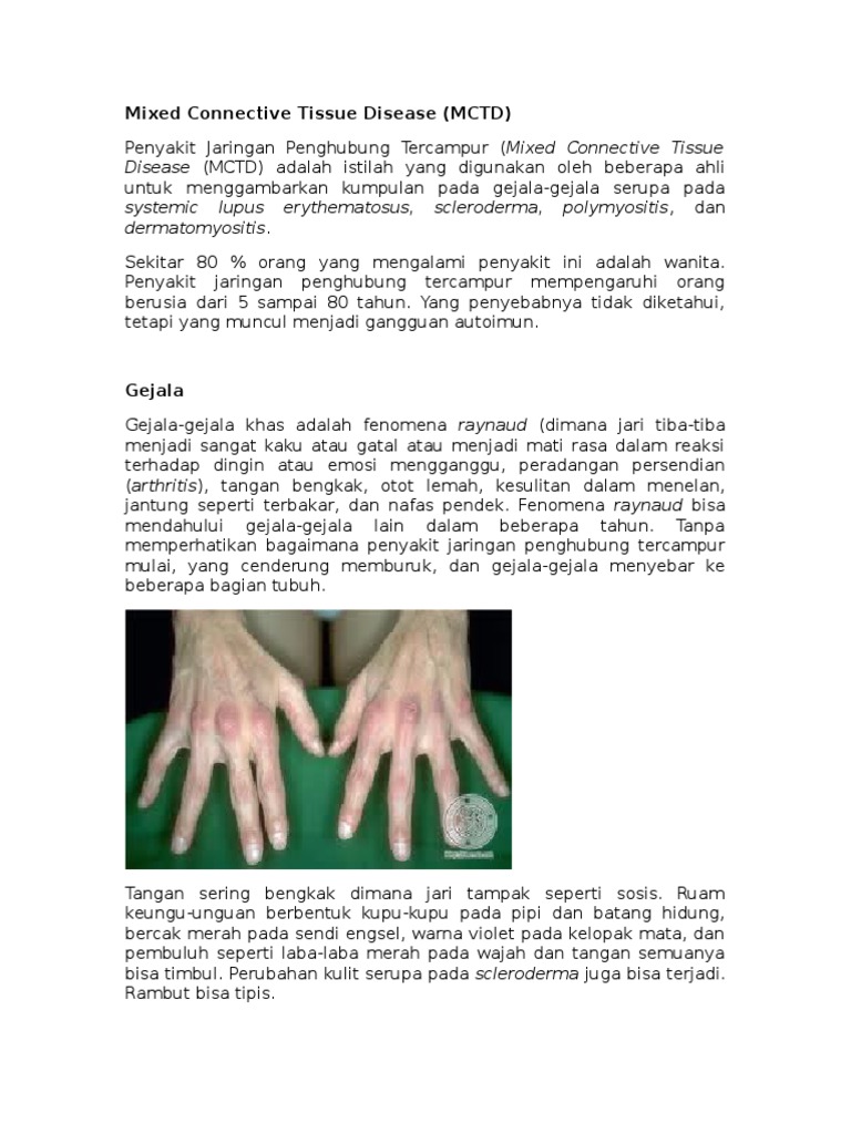 Mixed Connective Tissue Disease | PDF