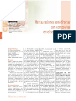 173 CIENCIA Restauraciones Semidirectas Composites PDF